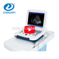 DW-580 portable laptop B/W ultrasound machine price full digital ultrasound scanner from Dawei ultrasound